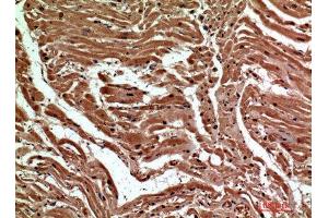 Immunohistochemistry (IHC) analysis of paraffin-embedded Human Heart, antibody was diluted at 1:200. (C-Type Lectin Domain Family 6, Member A (CLEC6A) antibody)