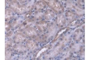 DAB staining on IHC-P; Samples: Rat Kidney Tissue (ERP29 antibody  (AA 42-173))