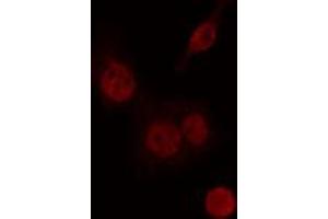 ABIN6274235 staining Hela cells by IF/ICC. (CIITA antibody  (Internal Region))