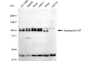 Western blotting analysis using Nucleoporin 107 antibody (ABIN7799674).