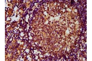 IHC image of ABIN7143386 diluted at 1:500 and staining in paraffin-embedded human lymph node tissue performed on a Leica BondTM system. (ADGRE2 antibody  (AA 151-323))