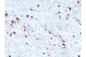 Formalin-fixed, paraffin-embedded human spleen stained with IgM Recombinant Rabbit Monoclonal Antibody (IGHM/3776R). (Recombinant IGHM antibody)