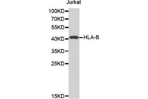 Western blot analysis of extracts of Jurkat cell line, using HLA-B antibody. (HLA-B antibody  (AA 1-100))