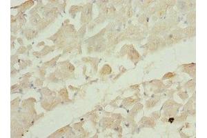 Immunohistochemistry of paraffin-embedded human heart tissue using ABIN7167216 at dilution of 1:100 (RRAS2 antibody  (AA 1-204))
