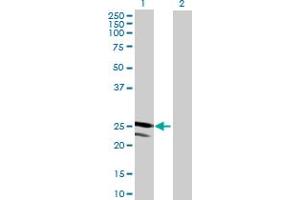 Western Blot analysis of TMED4 expression in transfected 293T cell line by TMED4 MaxPab polyclonal antibody. (TMED4 antibody  (AA 1-227))
