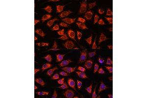 Immunofluorescence analysis of L929 cells using PI4KB antibody (ABIN7269287) at dilution of 1:100. (PI4KB antibody  (AA 560-801))