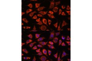 Immunofluorescence analysis of L929 cells using PI4KB antibody (ABIN7269287) at dilution of 1:100. (PI4KB antibody  (AA 560-801))