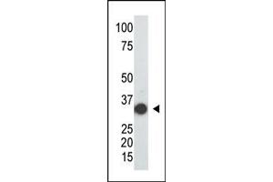 Image no. 1 for anti-Sulfotransferase Family, Cytosolic, 2A, Dehydroepiandrosterone (DHEA)-Preferring, Member 1 (SULT2A1) (C-Term) antibody (ABIN357808) (SULT2A1 antibody  (C-Term))