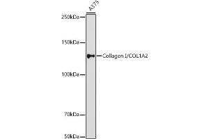 Western blot analysis of extracts of  cells, using Collagen I/COL1 antibody (ABIN6134502, ABIN6138839, ABIN6138840 and ABIN6221469) at 1:1000 dilution. (COL1A2 antibody  (AA 500-600))