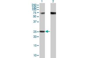 Western Blot analysis of RPP40 expression in transfected 293T cell line by RPP40 MaxPab polyclonal antibody. (RPP40 antibody  (AA 1-244))