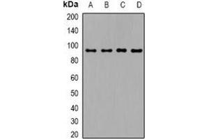 Western blot analysis of TGFBR3 expression in mouse kidney (A), mouse heart (B), mouse brain (C), mouse lung (D) whole cell lysates. (TGFBR3 antibody  (C-Term))
