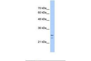 Image no. 1 for anti-Signal Recognition Particle Receptor, B Subunit (SRPRB) (C-Term) antibody (ABIN321640) (SRPRB antibody  (C-Term))