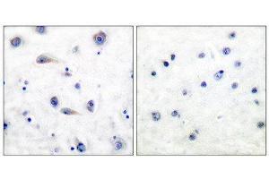Immunohistochemistry (IHC) image for anti-Neurotrophic Tyrosine Kinase, Receptor, Type 2 (NTRK2) (pTyr515) antibody (ABIN1847227) (TRKB antibody  (pTyr515))