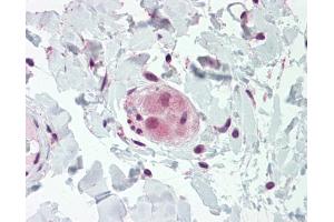 IHC-P Image RHOU antibody detects RHOU protein at cytoplasm on human placenta by immunohistochemical analysis. (RHOU antibody  (N-Term))