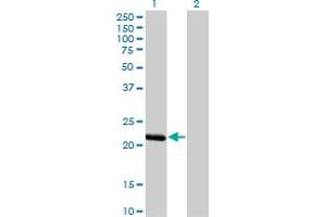 Western Blot analysis of BCL2L10 expression in transfected 293T cell line by BCL2L10 monoclonal antibody (M03), clone 1B11. (BCL2L10 antibody  (AA 1-92))