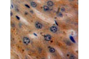 Used in DAB staining on fromalin fixed paraffin-embedded Liver tissue (alpha 2 Antiplasmin antibody  (AA 340-491))