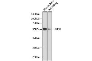 Western blot analysis of extracts of various cell lines, using SUFU antibody (ABIN6133029, ABIN6148692, ABIN6148694 and ABIN6217424) at 1:1000 dilution. (SUFUH antibody  (AA 325-484))