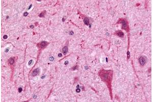 Anti-GPR75 antibody  ABIN1048866 IHC staining of human brain, neurons and glia. (GPR75 antibody  (C-Term))