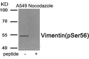 Western blot analysis of extracts from A549 cells treated with Nocodazole using Phospho-Vimentin (Ser56) antibody. (Vimentin antibody  (pSer56))