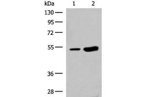 Western blot analysis of Human left thymus tissue and Mouse kidney tissue lysates using ZBTB43 Polyclonal Antibody at dilution of 1:250 (ZBTB43 antibody)