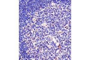 (ABIN657676 and ABIN2846668) staining SF3B1 in human tonsil tissue sections by Immunohistochemistry (IHC-P - paraformaldehyde-fixed, paraffin-embedded sections). (SF3B1 antibody  (N-Term))