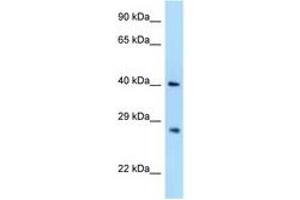 Image no. 1 for anti-Axin Interactor, Dorsalization Associated (AIDA) (AA 48-97) antibody (ABIN6748006) (AIDA antibody  (AA 48-97))