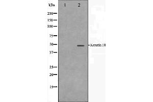 Western Blotting (WB) image for anti-Keratin 18 (KRT18) (C-Term) antibody (ABIN6262779)