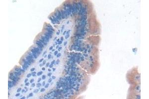 Detection of TNFa in Mouse Uterus Tissue using Monoclonal Antibody to Tumor Necrosis Factor Alpha (TNFa) (TNF alpha antibody  (AA 80-235))