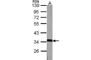 Western Blotting (WB) image for anti-Annexin A5 (ANXA5) antibody (ABIN2855592)