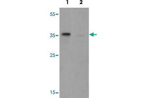 Western blot analysis of TSPY1 in A-20 cell lysate with TSPY1 polyclonal antibody  at 1 ug/mL in (1) the absence and (2) the presence of blocking peptide. (TSPY1 antibody  (C-Term))