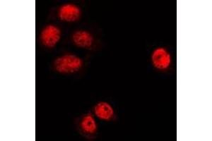 Immunofluorescent analysis of MGCRACGAP staining in K562 cells. (RACGAP1 antibody  (N-Term))