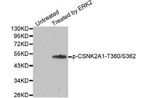 Western blot analysis of extracts from 293 cells, using Phospho-CSNK2A1-T360/S362 antibody. (CSNK2A1/CK II alpha antibody  (pSer362, pThr360))