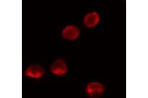 ABIN6274136 staining LOVO cells by IF/ICC. (MED26 antibody  (N-Term))