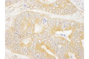 Immunohistochemistry (IHC) image for anti-Growth Factor Receptor-Bound Protein 10 (GRB10) (AA 100-150) antibody (ABIN7448583) (GRB10 antibody  (AA 100-150))