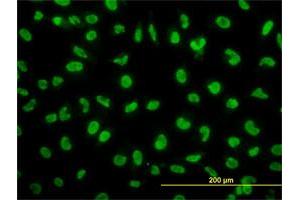 Immunofluorescence of monoclonal antibody to SNAI2 on HeLa cell. (SLUG antibody  (AA 97-169))