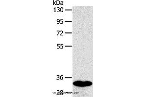 Western blot analysis of Human fetal intestines tissue, using SULT1B1 Polyclonal Antibody at dilution of 1:800 (SULT1B1 antibody)