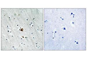Immunohistochemistry (IHC) image for anti-Mitogen-Activated Protein Kinase-Activated Protein Kinase 2 (MAPKAPK2) (pSer272) antibody (ABIN1847788) (MAPKAP Kinase 2 antibody  (pSer272))