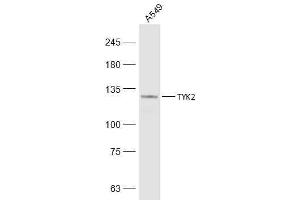 A549 lysates probed with TYK2 Polyclonal Antibody, Unconjugated  at 1:500 dilution and 4˚C overnight incubation. (TYK2 antibody  (AA 401-500))