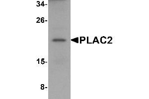 Western Blotting (WB) image for anti-Tissue Differentiation-Inducing Non-Protein Coding RNA (TINCR) (Middle Region) antibody (ABIN1031042) (PLAC2 antibody  (Middle Region))