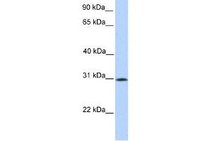 SIGLEC12 antibody used at 1 ug/ml to detect target protein. (SIGLEC12 antibody  (N-Term))