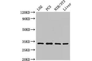 Western Blot Positive WB detected in: LO2 whole cell lysate, PC-3 whole cell lysate, NIH/3T3 whole cell lysate, Rat liver tissue All lanes: SIX1 antibody at 2. (SIX Homeobox 1 antibody  (AA 144-262))