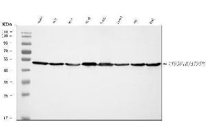 Western blot analysis of ATP5F1B using anti-ATP5F1B antibody (ABIN7599866). (Atp5f1b (AA 123-529) antibody)