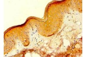 Immunohistochemistry of paraffin-embedded human skin tissue using ABIN7154836 at dilution of 1:100 (C14orf94 antibody  (AA 1-363))