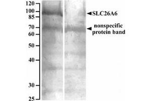 AP32082PU-N SLC26A6 Antibody staining of Human renal cortical brush-border membrane lysate at 10 µg/ml (90 µg protein denatured at 37°C for 30min) with (B) and without (A) blocking with the immunizing peptide. (SLC26A6 antibody  (Internal Region))
