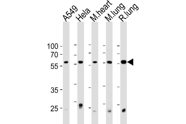 PSMC1 antibody  (C-Term)