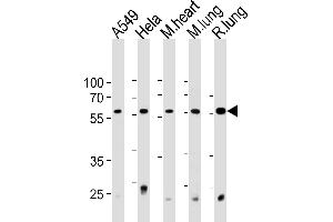 PRS4 Antibody (C-term) (ABIN1881692 and ABIN2843376) western blot analysis in A549,Hela cell line and mouse heart and lung,rat lung tissue lysates (35 μg/lane). (PSMC1 antibody  (C-Term))