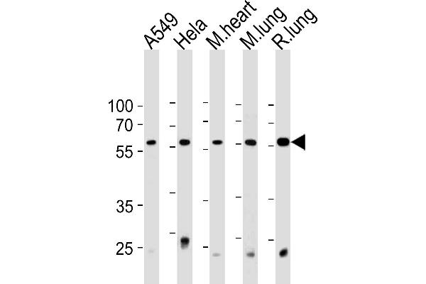 PSMC1 抗体  (C-Term)