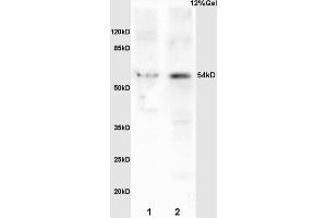 L1 mouse brain lysates L2 mouse embryo lysates probed with Anti Phospho-MEF2A (Ser408) Polyclonal Antibody, Unconjugated (ABIN743783) at 1:200 overnight at 4 °C. (MEF2A antibody  (pSer408))
