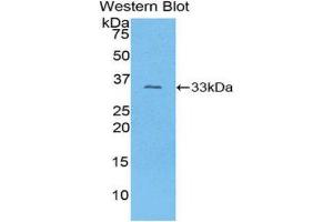 Western Blotting (WB) image for anti-Collagen, Type I, alpha 1 (COL1A1) (AA 1225-1453) antibody (ABIN1077674) (COL1A1 antibody  (AA 1225-1453))