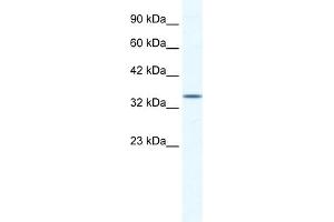WB Suggested Anti-ZFP589 Antibody Titration:  1. (ZFP589 (Middle Region) antibody)